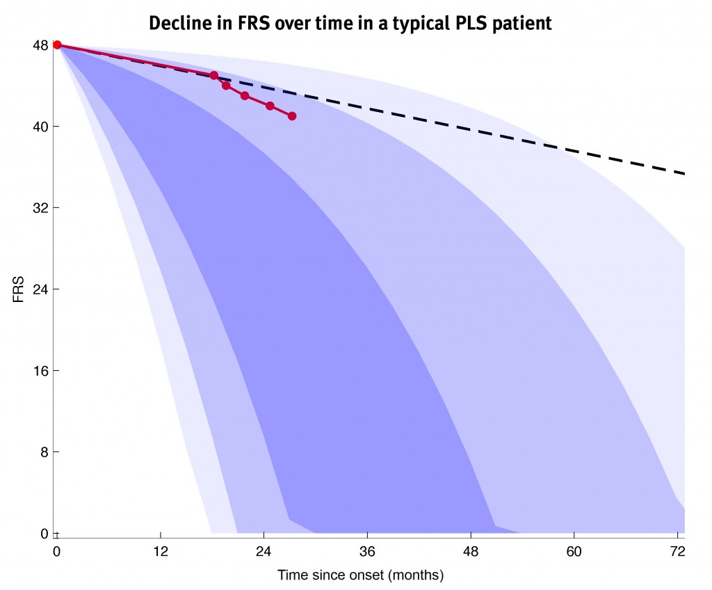 pls-patient-on-als-curves_ls2