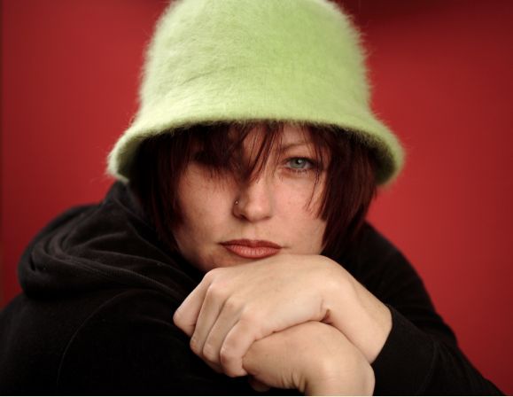 A cute hat can help to cover thinning hair or bald spots.  Image courtesy of Stock Free Images.